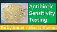 Kirby Bauer - Disc Diffusion Method for Antibiotic Susceptibility Testing