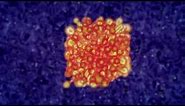 Immunotherapy: Boosting the immune system to fight cancer