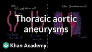 Thoracic aortic aneurysms | Circulatory System and Disease | NCLEX-RN | Khan Academy