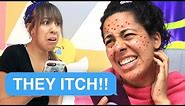 I HAVE THE CHICKEN POX! (Family Group Texts in Real Life)