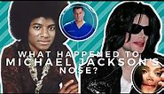 Plastic Surgeon Explains: Michael Jackson's Botched Nose Job and Plastic Surgery