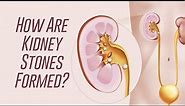 How Kidney Stones are Formed?