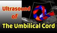 Ultrasound of the Umbilical Cord