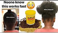 Mix Sulphur 8 , Cloves & Rosemary for Massive Hair Growth! Sulphur 8 Hair growth mixture ! It works