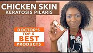 Keratosis Pilaris, Chicken Skin | BEST PRODUCTS for Black Skin: CeraVe, Paula's Choice, Necessaire