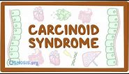 Carcinoid Syndrome - causes, symptoms, diagnosis, treatment, pathology