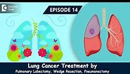Role of Pulmonary Lobectomy, Wedge Resection & Pneumonectomy in Lung Cancer | Dr.Sandeep Nayak