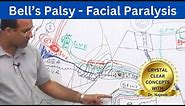 Bell’s Palsy | Facial Paralysis | Neuroscience