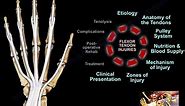 Flexor Tendon Injuries - Everything You Need To Know - Dr. Nabil Ebraheim
