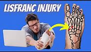 Lisfranc Injuries: EVERYTHING You Need to Know!