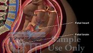 Umbilical Cord Compression - Maternal Fetal Circulation Medical 3D Animation