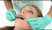 Interlandi Orthodontic Headgear Girl