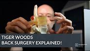Tiger Woods Back Surgery Explained!