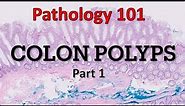 Colon Polyps | Part 1| Pathology 101
