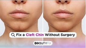 How to Remedy a Cleft Chin Without Surgery? | BeautyFix