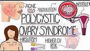 Polycystic Ovary Syndrome Made Easy (PCOS Explained)