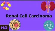 Renal Cell Carcinoma: Everything You Need To Know