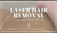 Laser Hair Removal: Things To Know Before & After