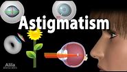 Astigmatism: Types, Causes, Symptoms and Treatment Options, Animation