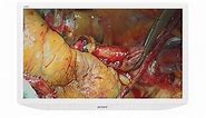 LMD-X3200MD 32-inch 4K 2D LCD medical monitor - Sony Pro