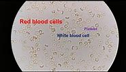 Red Blood Cells under the Microscope 400X and 1000X - Part 1