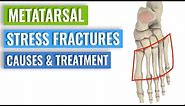 Metatarsal Stress Fractures - Causes, Treatment, Prevention