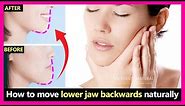 How to fix underbite, protruding jaw, move lower jaw backwards naturally | Prognathism jaw exercises
