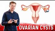 Ovarian Cysts: Causes, Symptoms & Natural Treatment – Dr.Berg