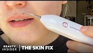 Heated Needle Tool Claims To Remove Skin Tags And Moles At Home | The Skin Fix | Beauty Insider