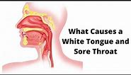 What Causes a White Tongue and Sore Throat