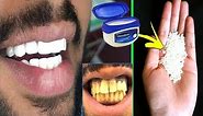 In Just 2 Minutes, Turn Yellow Teeth To Pearl White and Shine, Teeth Whiten at Home everyday culture