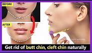 How to get rid of butt chin, cleft chin, chin dimples naturally. Make smooth and rounded chin shape.