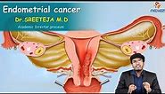 Endometrial Cancer : Obstetrics and gynaecology Video lectures Version 2.0 ( Medvizz app )