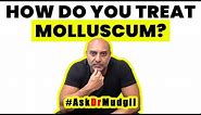 HOW DO YOU TREAT MOLLUSCUM?