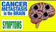 Cancer Metastasis in the Brain - All Symptoms