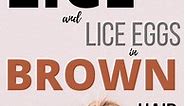 Brown Lice and Lice Eggs & Brown Hair with Lice - My Lice Advice