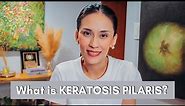 What is Keratosis Pilaris and how to Treat it? | Dr Gaile Robredo-Vitas