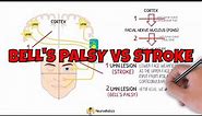Bell's palsy vs stroke - Facial nerve anatomy - Facial palsy | Neuroaholics