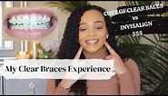 My Braces Experience | Invisalign vs Clear Braces Cost Breakdown
