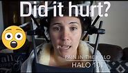 Surgical Halo Installation - Pain in the Halo - Living in a Surgical Halo Device
