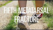 Fifth metatarsal fracture: Treatment options depending on the location of injury