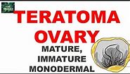 TERATOMA-OVARY: Ovarian Tumor Series Part 5
