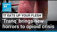 'It eats up your flesh': 'Tranq', the new drug worsening America's opioid epidemic • FRANCE 24