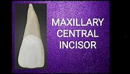 Maxillary central incisor