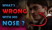 What's WRONG with Harry Potter's nose ?