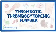 Púrpura trombocitopénica trombótica (NORD): Vídeo | Osmosis