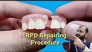 Removable partial denture repairing ||How to repair a broken partial dentur || Dental Art by Haider.