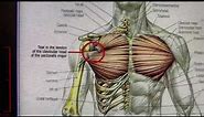 MoraMD: Pectoralis Major Tendon Tears- A must watch video for people who do benchpress.