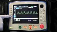 Instruction of the Zoll X Series - Part 6 (Cardioversion/Pacing)
