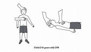 Differences Between Infant, Child, and Adult CPR - Avive AED
